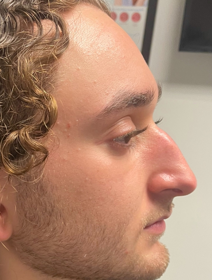 Before Image: Patient Case #2066 - right-side