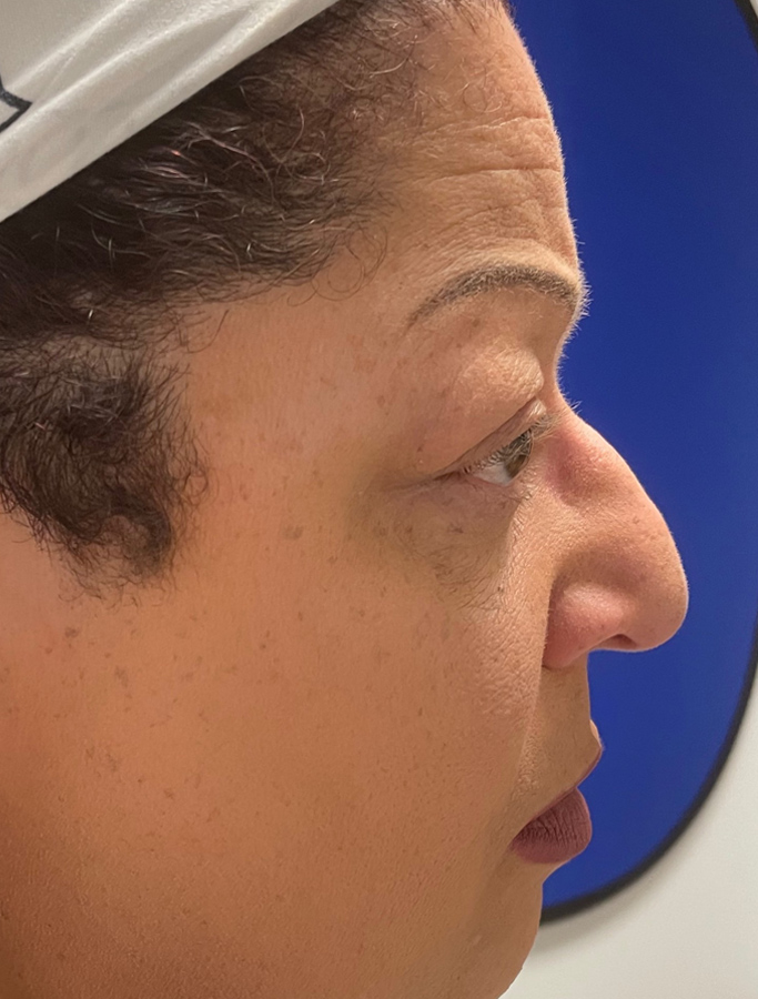 Before Image: Patient Case #2067 - right-side