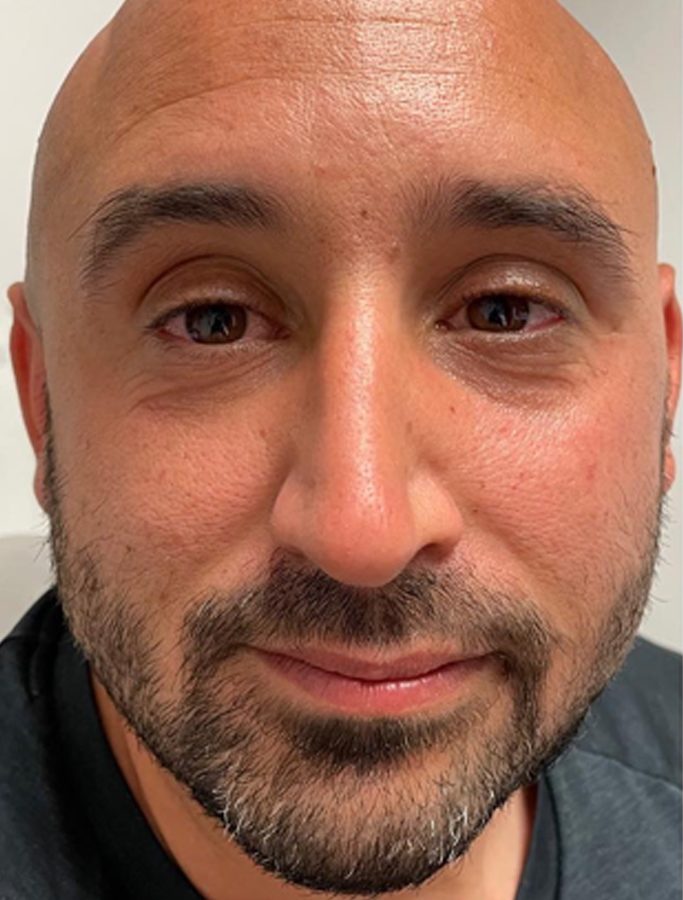 Before Image: Patient Case #2068 - front