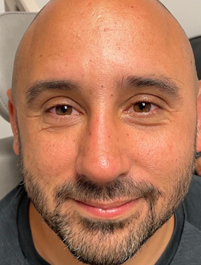 After Image: Patient Case #2068 - front