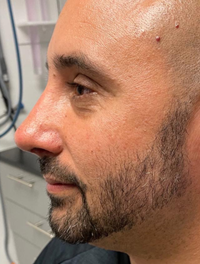 After Image: Patient Case #2068 - left-side