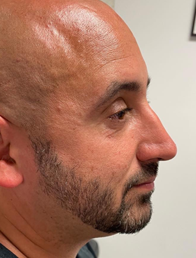 Before Image: Patient Case #2068 - right-side