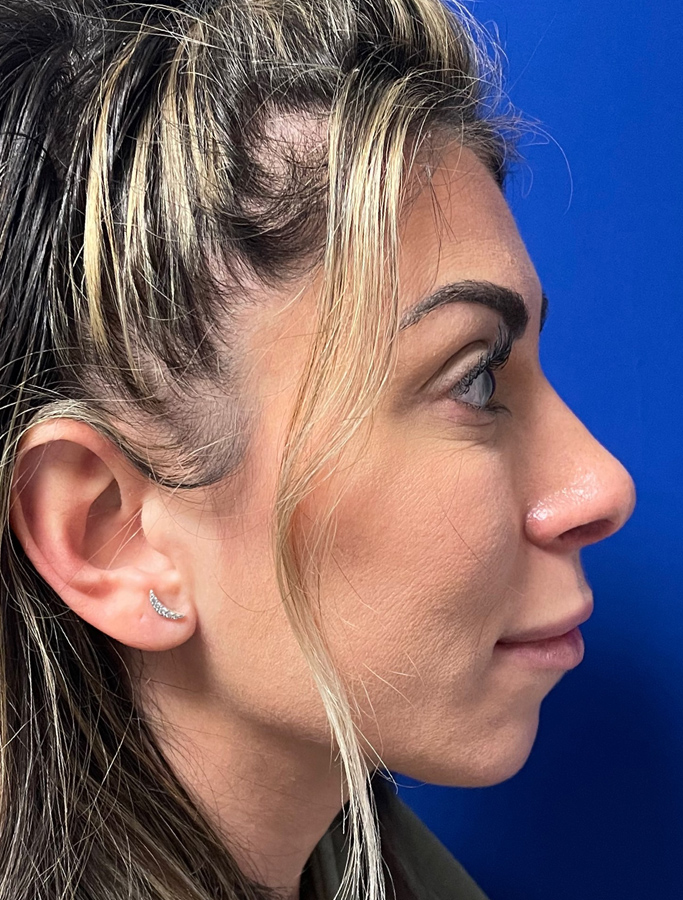 After Image: Patient Case #2069 - right-side