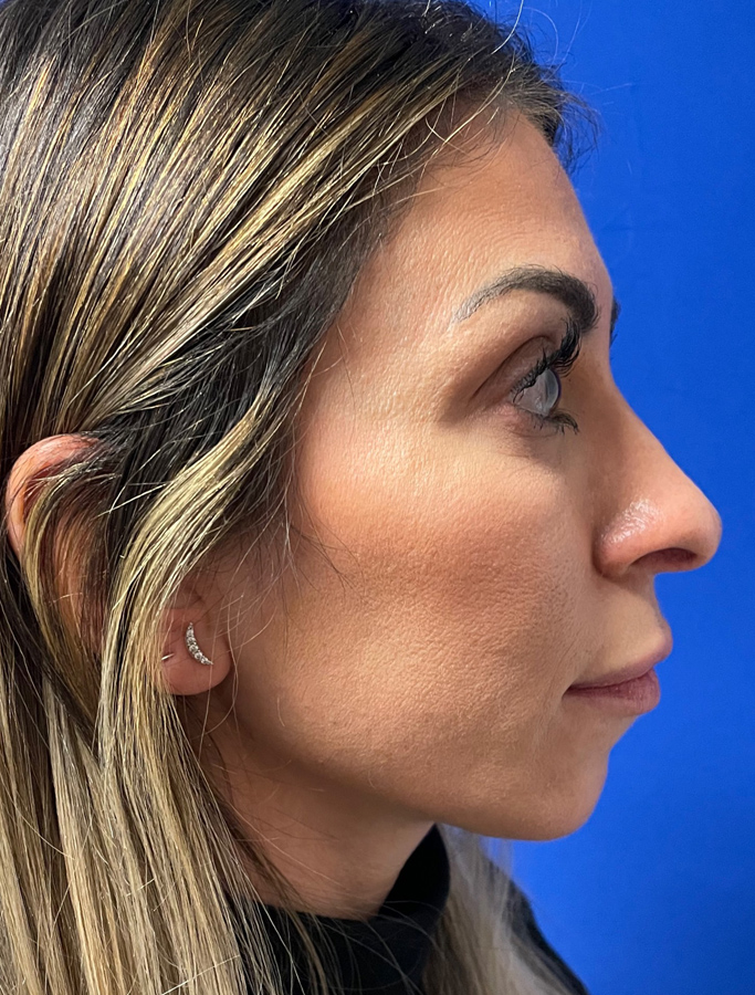 Before Image: Patient Case #2069 - right-side