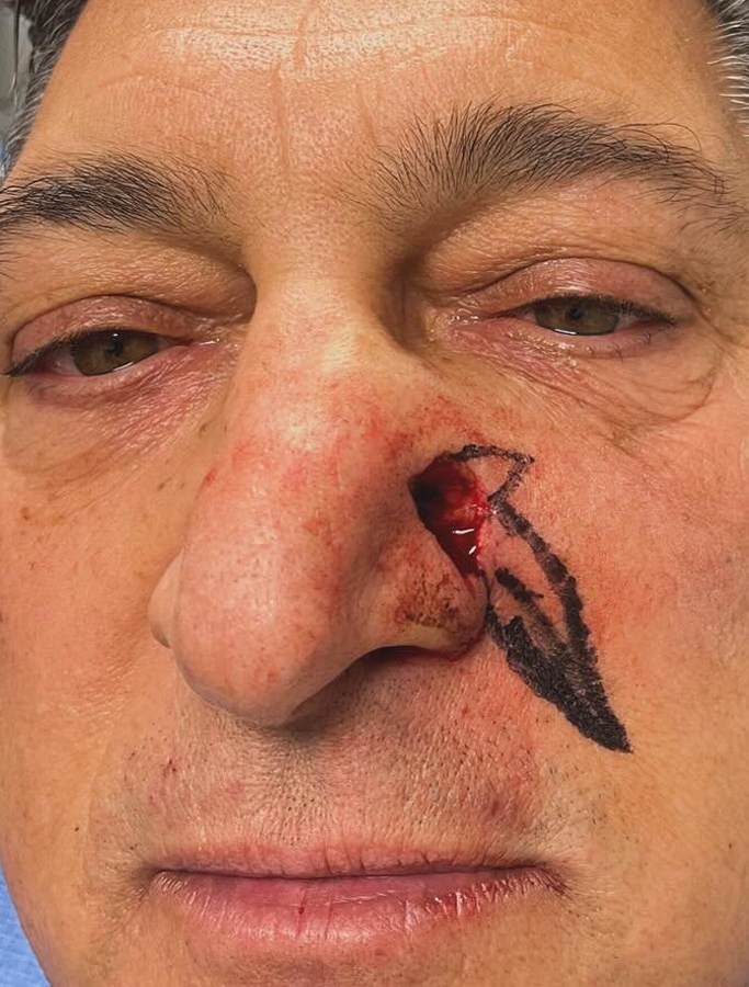 Before Image: Patient Case #1699 - front