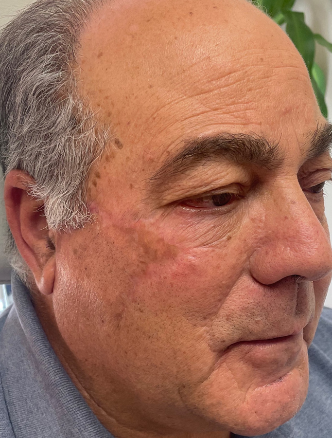 After Image: Patient Case #1718 - right-front-oblique