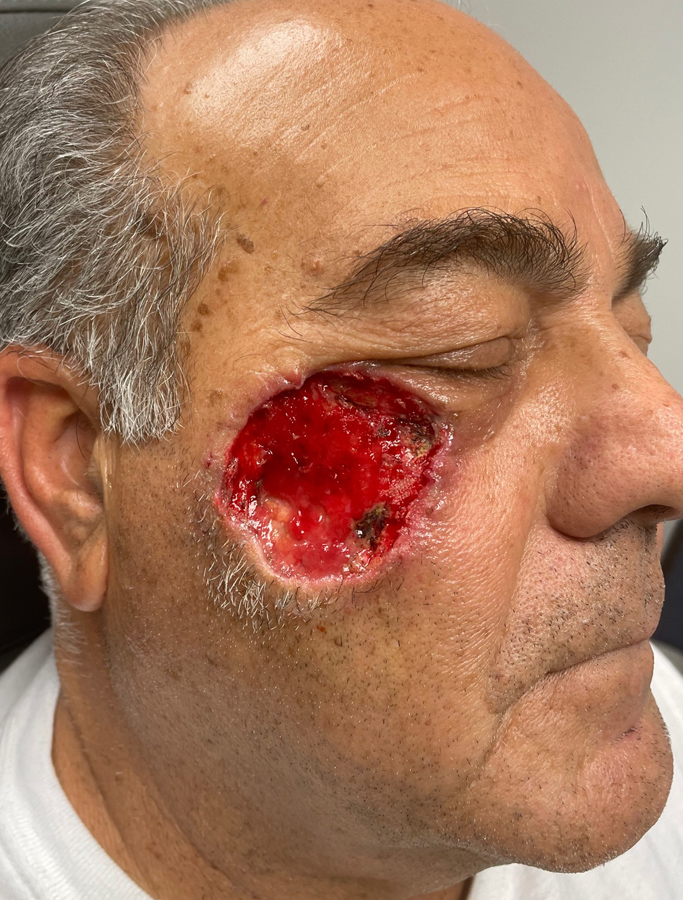 Before Image: Patient Case #1718 - right-front-oblique