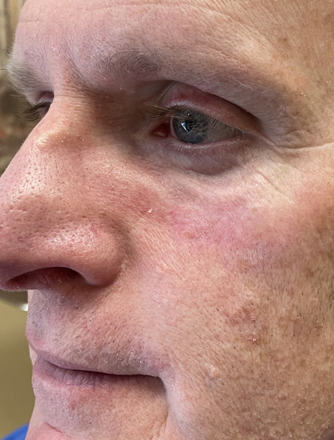 After Image: Patient Case #1720 - left-front-oblique