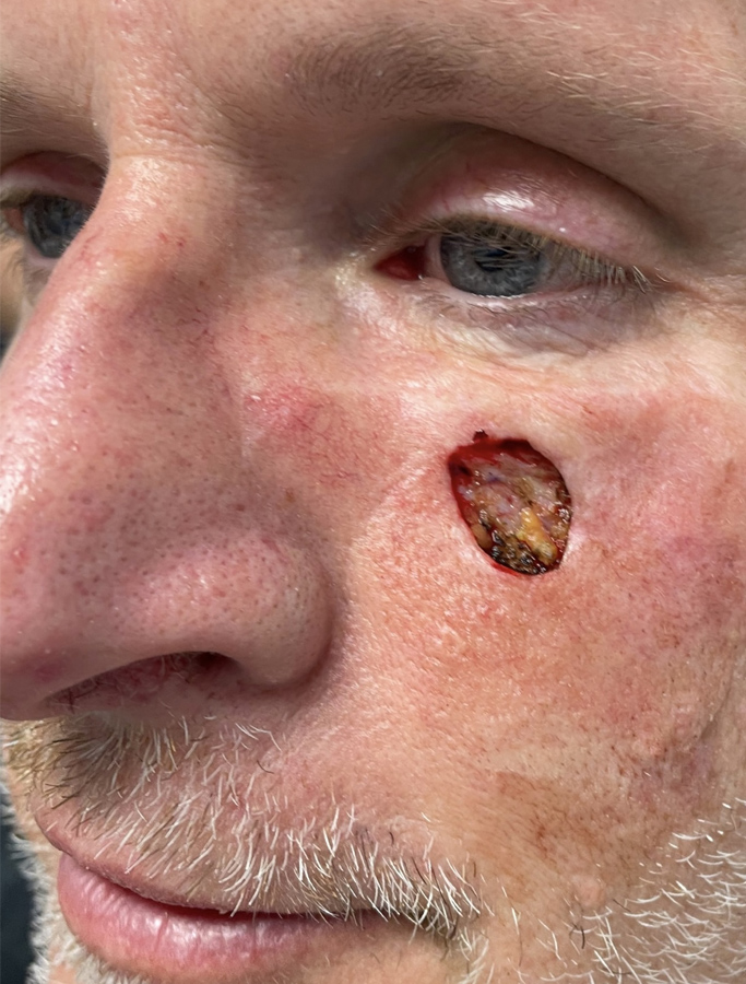 Before Image: Patient Case #1720 - left-front-oblique