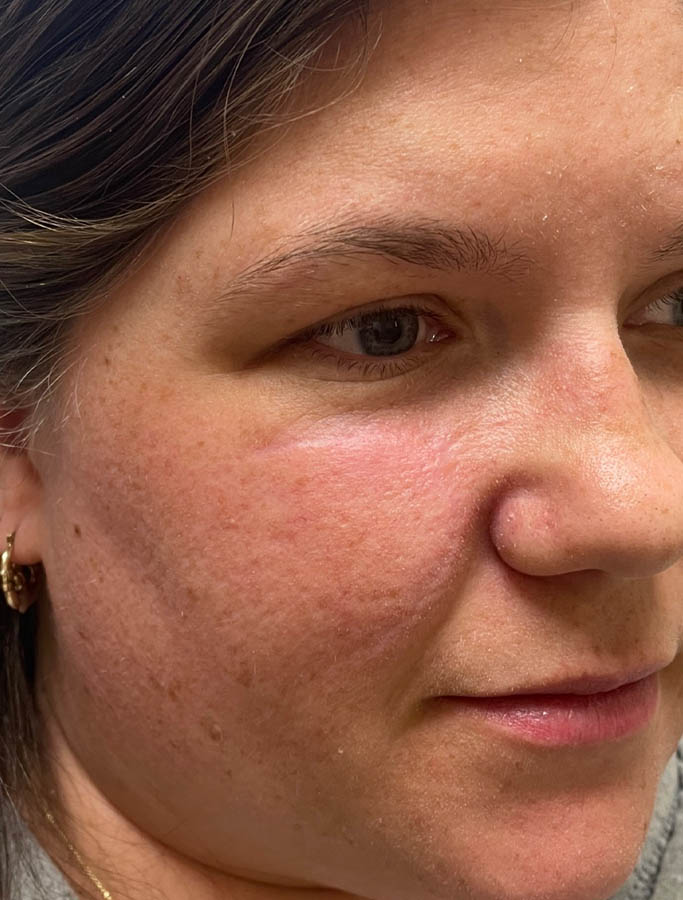 After Image: Patient Case #17941 - right-front-oblique