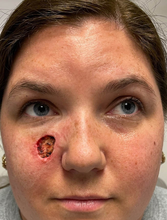 Before Image: Patient Case #17941 - front