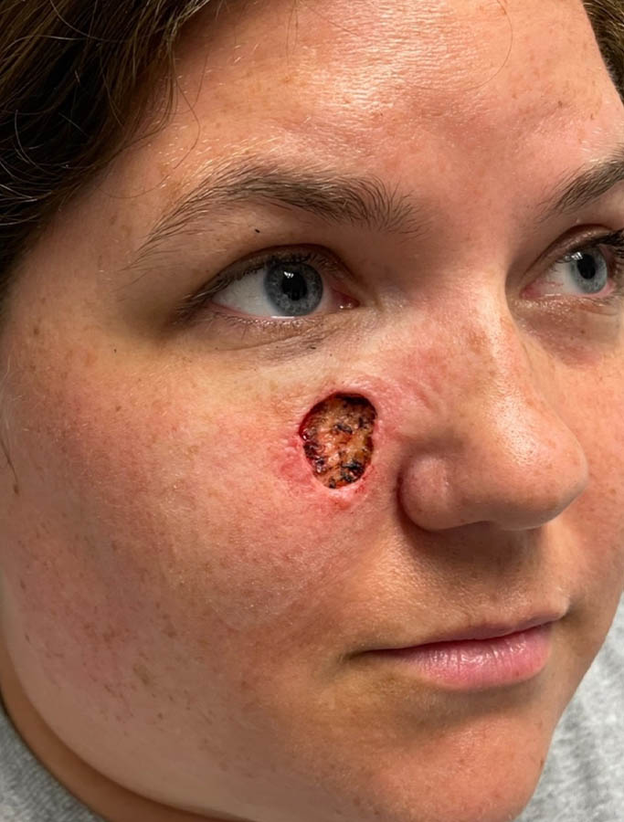 Before Image: Patient Case #17941 - right-front-oblique