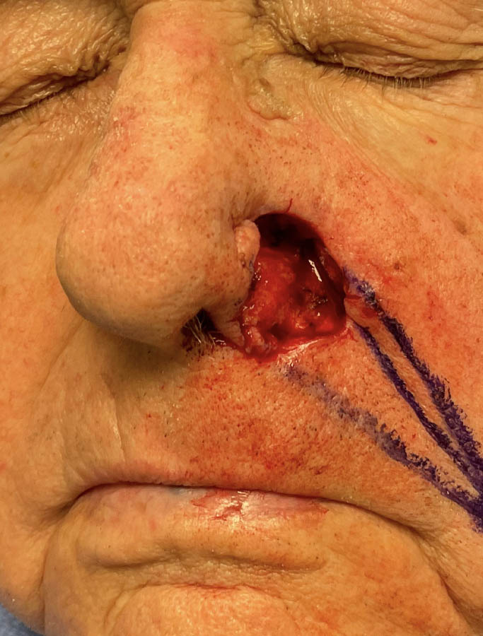 Before Image: Patient Case #17955 - left-front-oblique