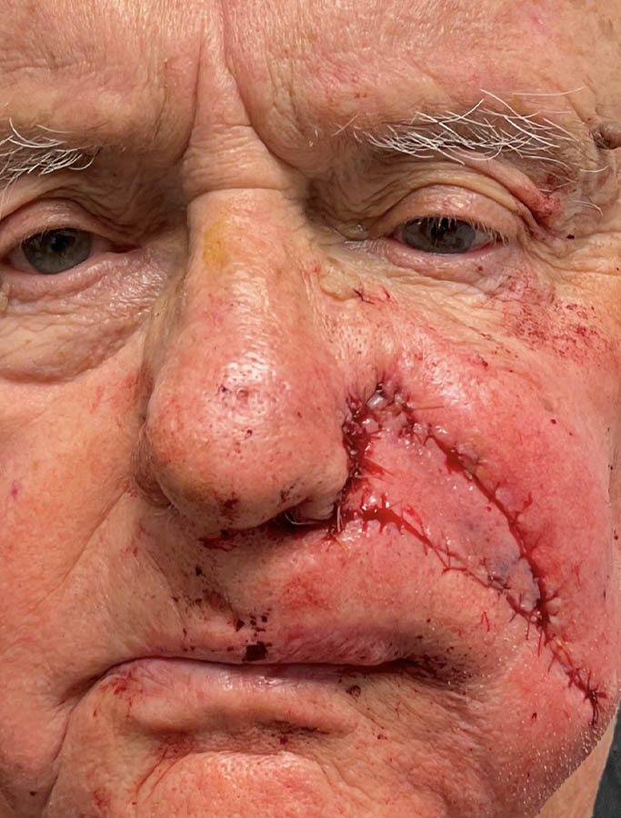 Before Image: Patient Case #17955 - front