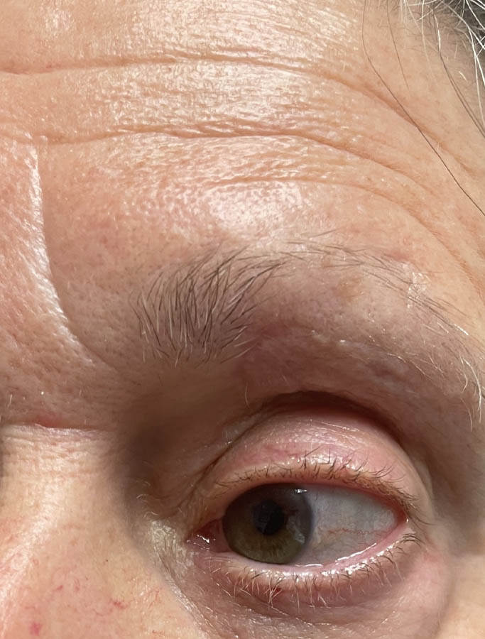 After Image: Patient Case #17969 - left-front-oblique