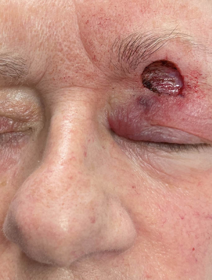 Before Image: Patient Case #17969 - left-front-oblique