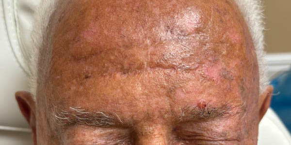 After Image: Patient Case #17983 - front