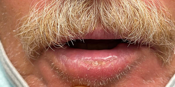 After Image: Patient Case #17986 - front