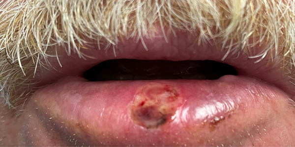 Before Image: Patient Case #17986 - front