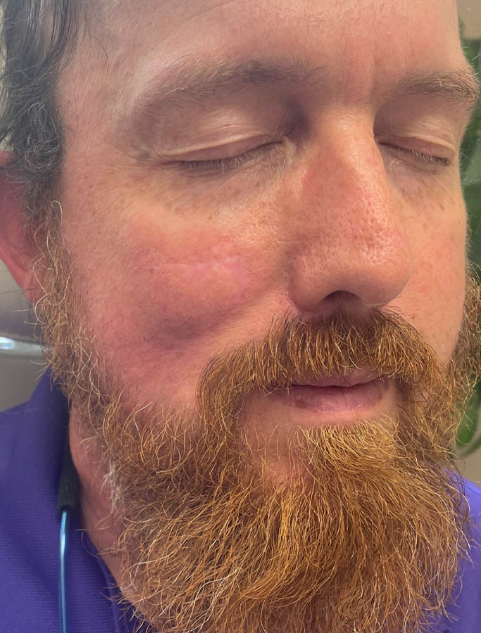 After Image: Patient Case #17995 - right-front-oblique