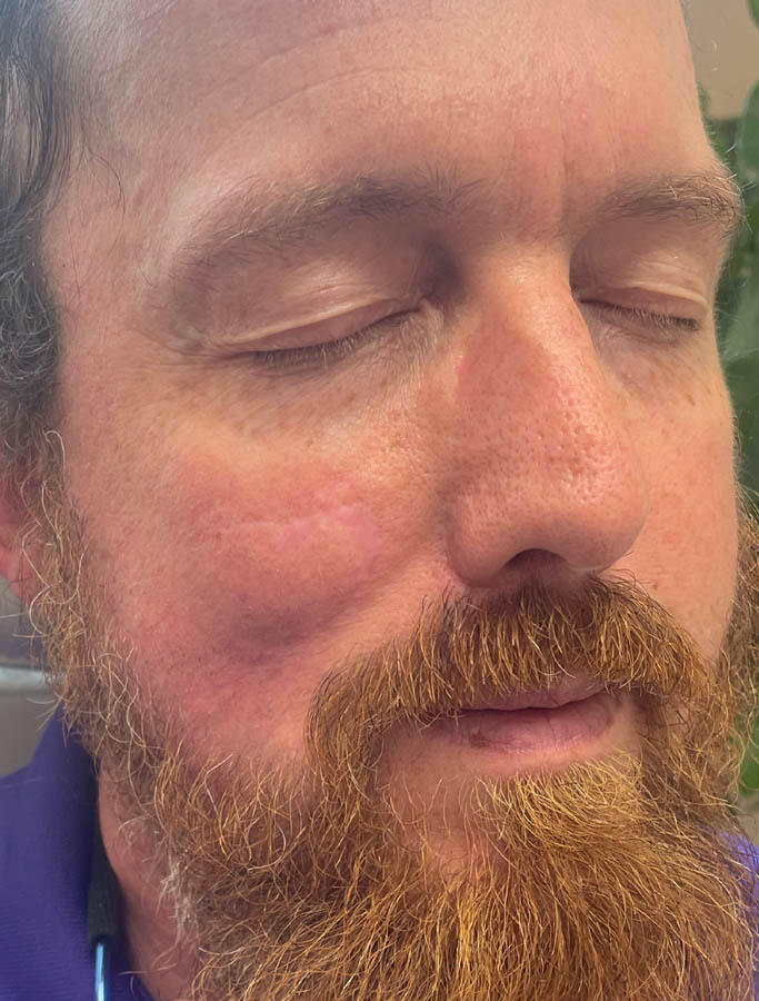 After Image: Patient Case #17995 - right-front-oblique