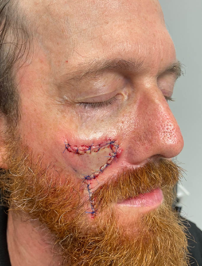 Before Image: Patient Case #17995 - right-front-oblique