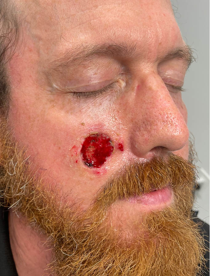 Before Image: Patient Case #17995 - right-front-oblique