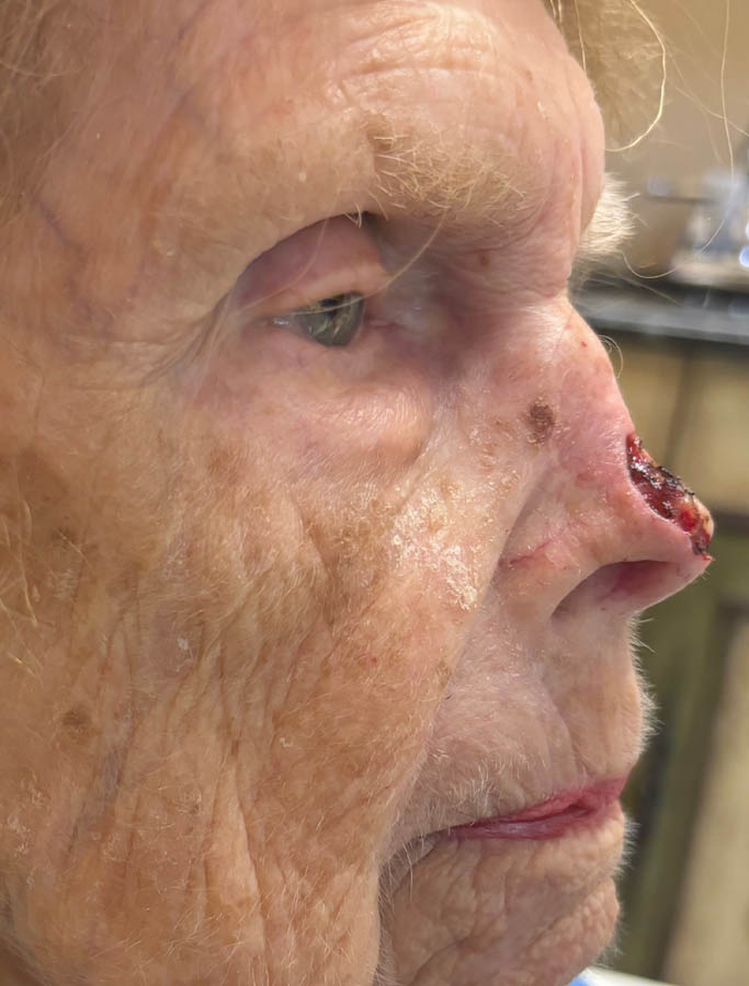 Before Image: Patient Case #18008 - right-side