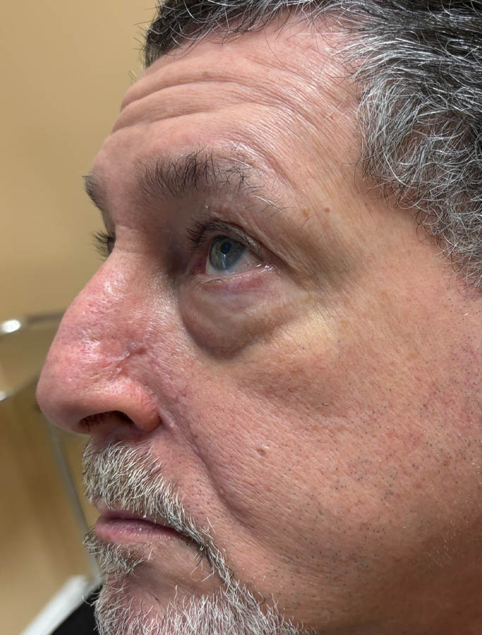 After Image: Patient Case #18022 - left-front-oblique