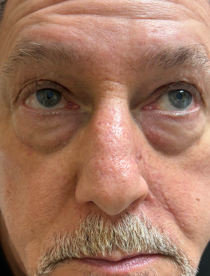 After Image: Patient Case #18022 - front