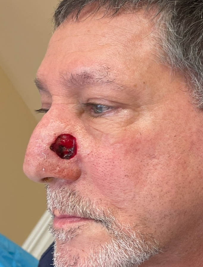 Before Image: Patient Case #18022 - left-front-oblique