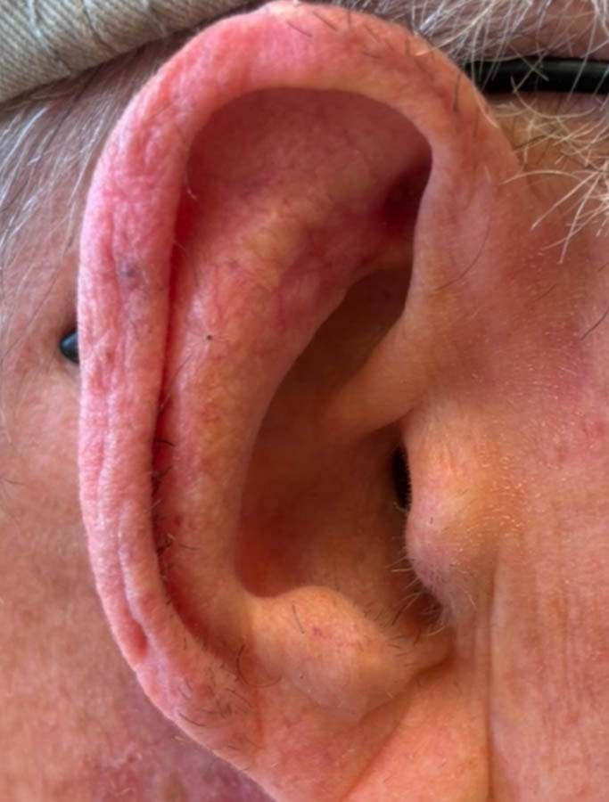 After Image: Patient Case #18032 - right-side