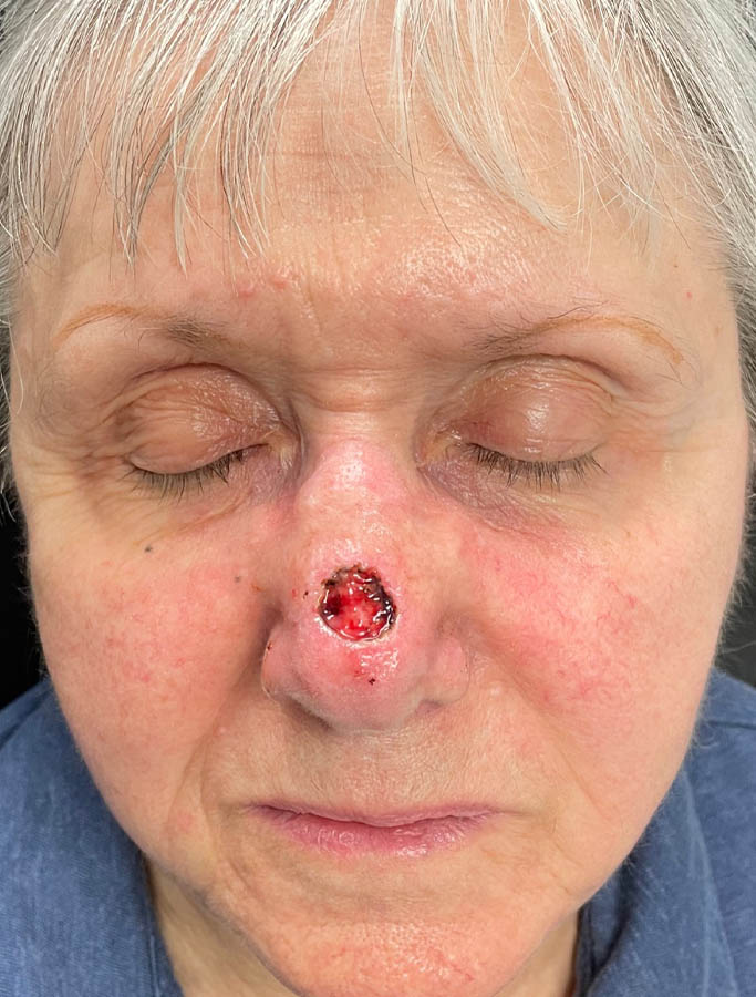 Before Image: Patient Case #18038 - front