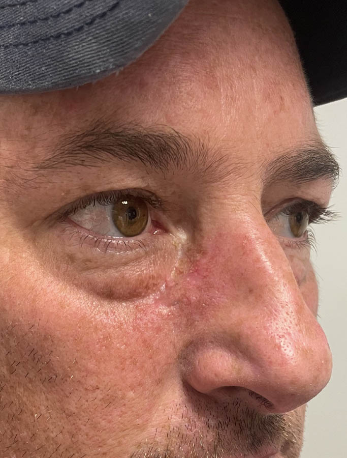 After Image: Patient Case #18045 - right-front-oblique