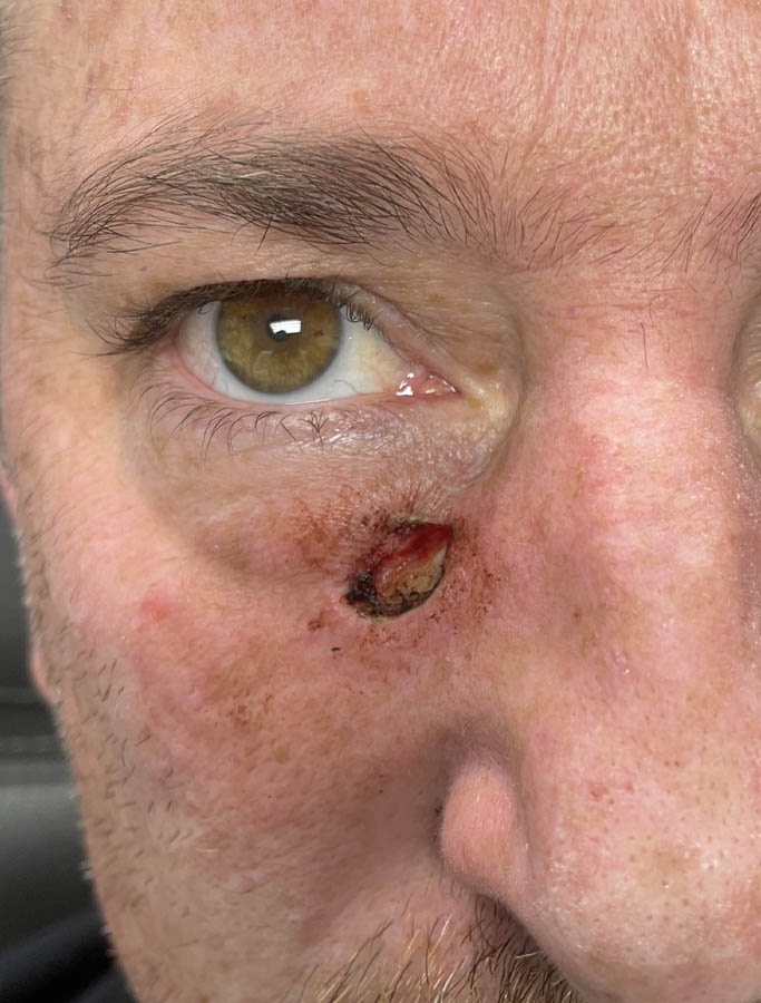 Before Image: Patient Case #18045 - front