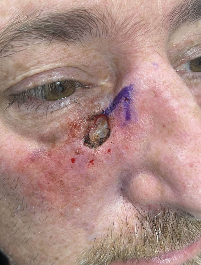 Before Image: Patient Case #18045 - right-front-oblique