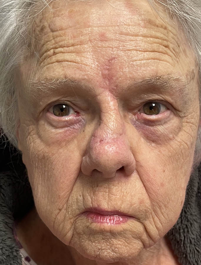 After Image: Patient Case #18048 - front