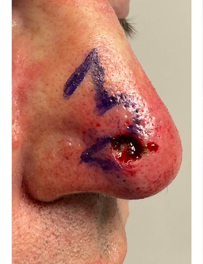 Before Image: Patient Case #18057 - right-side