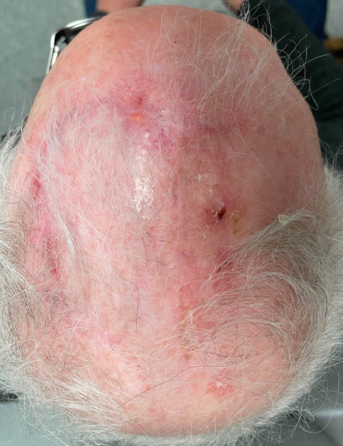 After Image: Patient Case #18060 - front