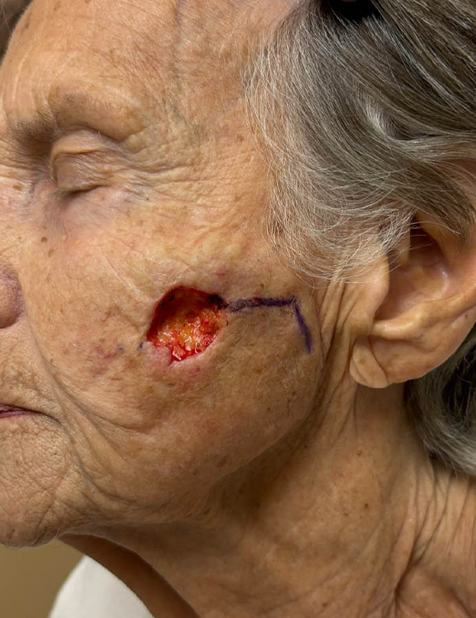 Before Image: Patient Case #18063 - left-side