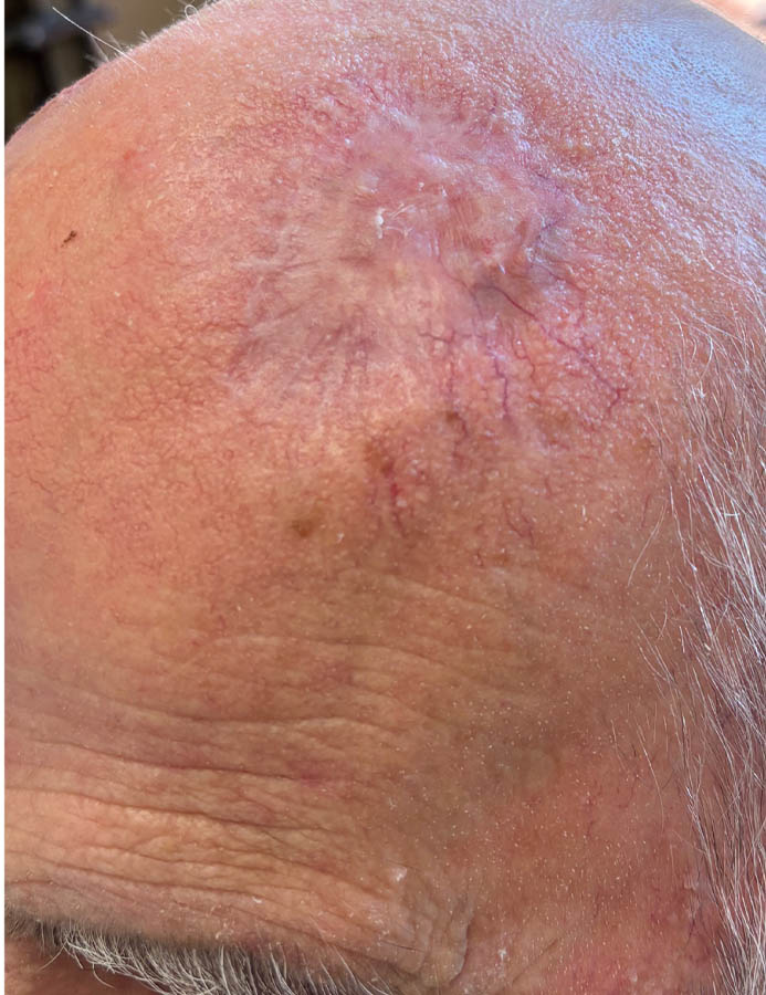 After Image: Patient Case #18071 - front