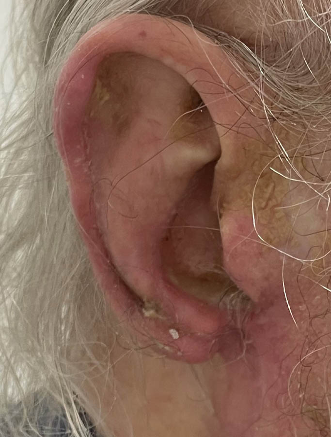 After Image: Patient Case #18077 - right-side