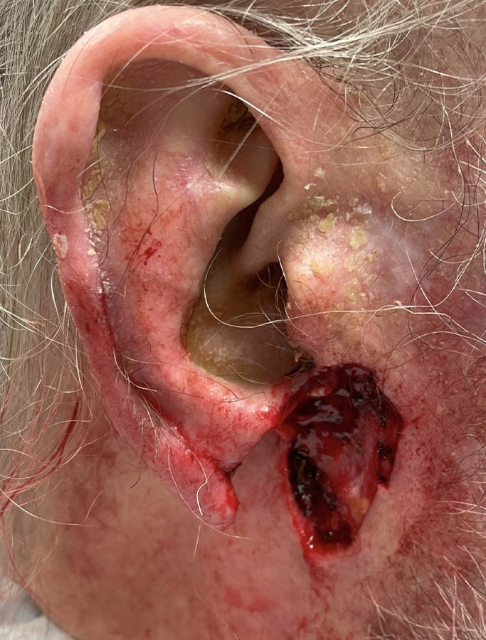 Before Image: Patient Case #18077 - right-side