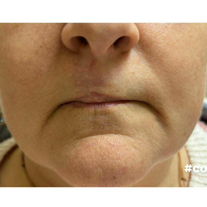 After Image: Patient Case #18600 - front