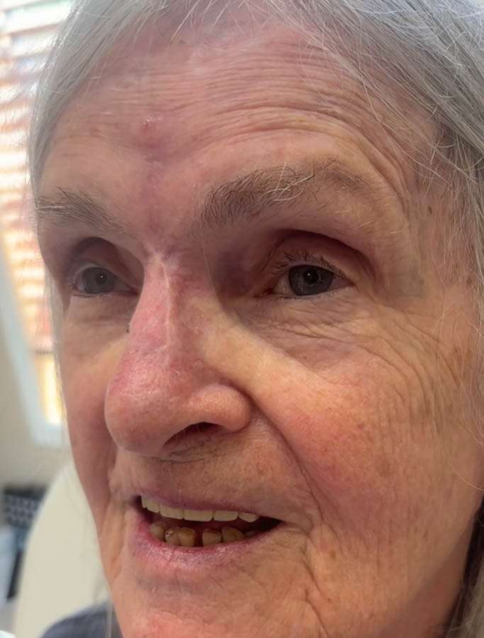 After Image: Patient Case #18882 - left-front-oblique