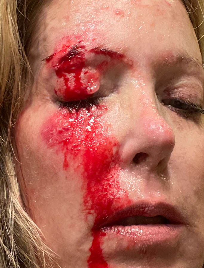 Before Image: Patient Case #17926 - right-front-oblique