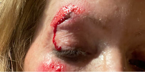 Before Image: Patient Case #17926 - right-front-oblique