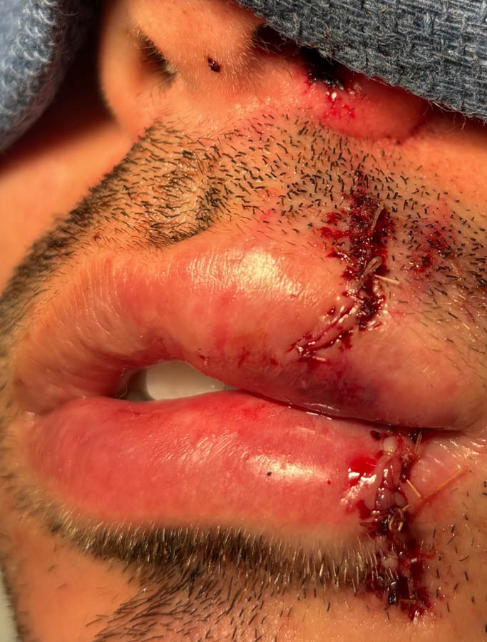 After Image: Patient Case #17931 - left-front-oblique