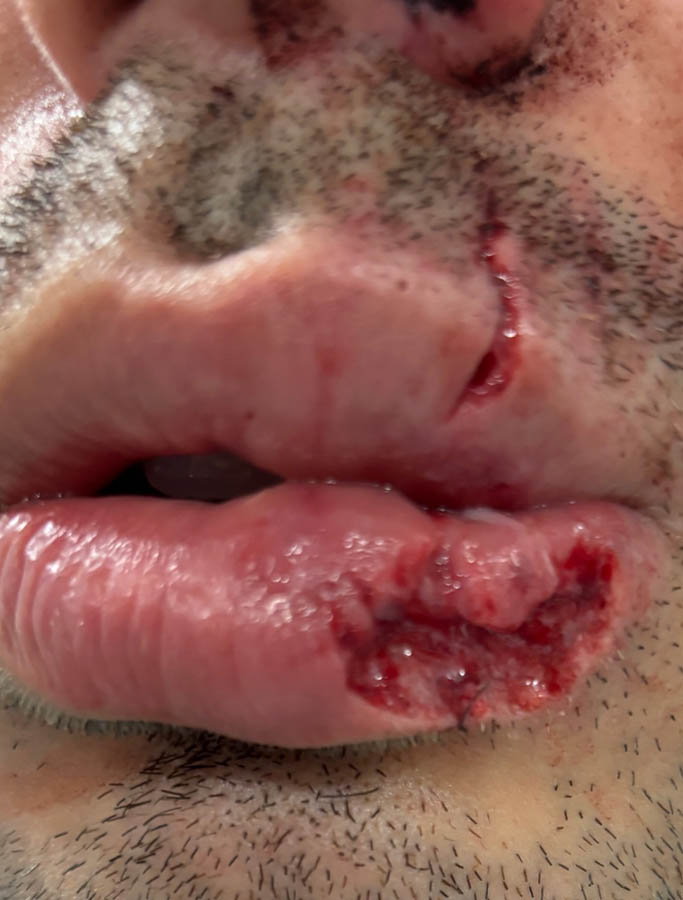 Before Image: Patient Case #17931 - left-front-oblique