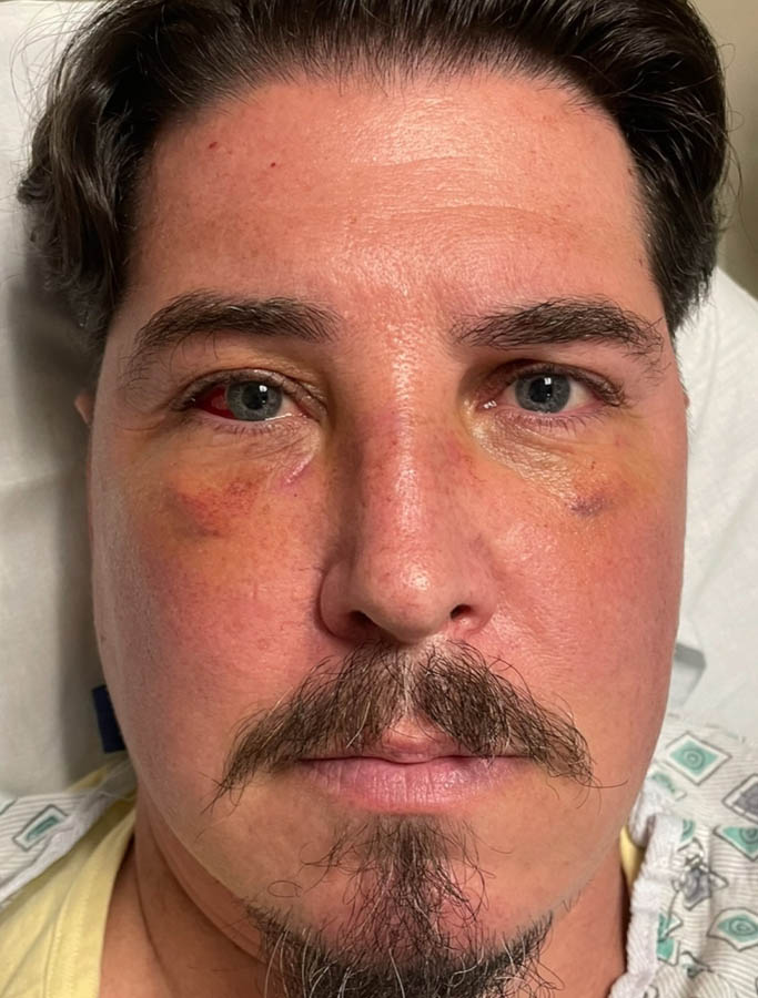 Before Image: Patient Case #17934 - front